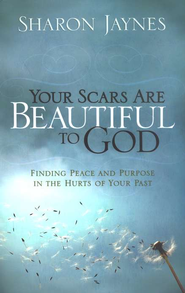 Your Scars Are Beautiful to God: Finding Peace and Purpose in the Hurts of Your