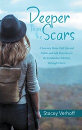 Deeper Than the Scars: A Journey from Cleft Lip and Palate and Self-Rejection to Re-Established Identity Through Christ - eBook