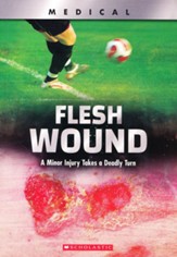 Flesh Wound!: A Minor Injury Takes a  Deadly Turn